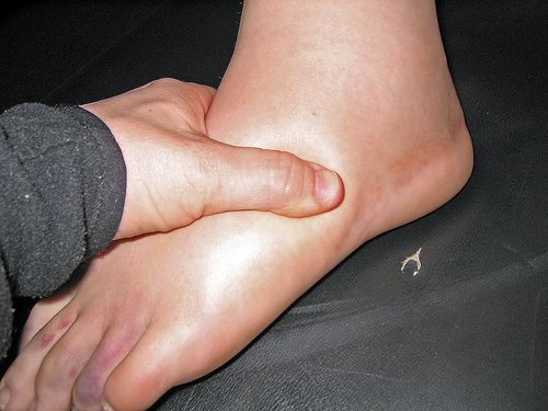 articulația umflată pe umflarea piciorului